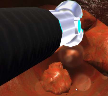 Cancer Sample Preparation for Mass Spectrometry